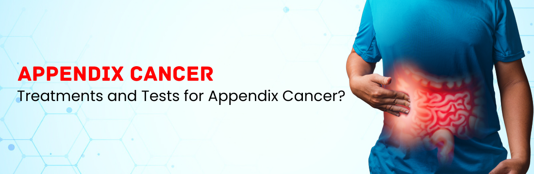 What are the Treatments and Tests for Appendix Cancer?